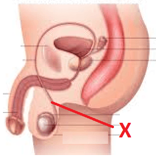 Bagian testis yang berperan dalam produksi sperma dan hormon testosteron disebut