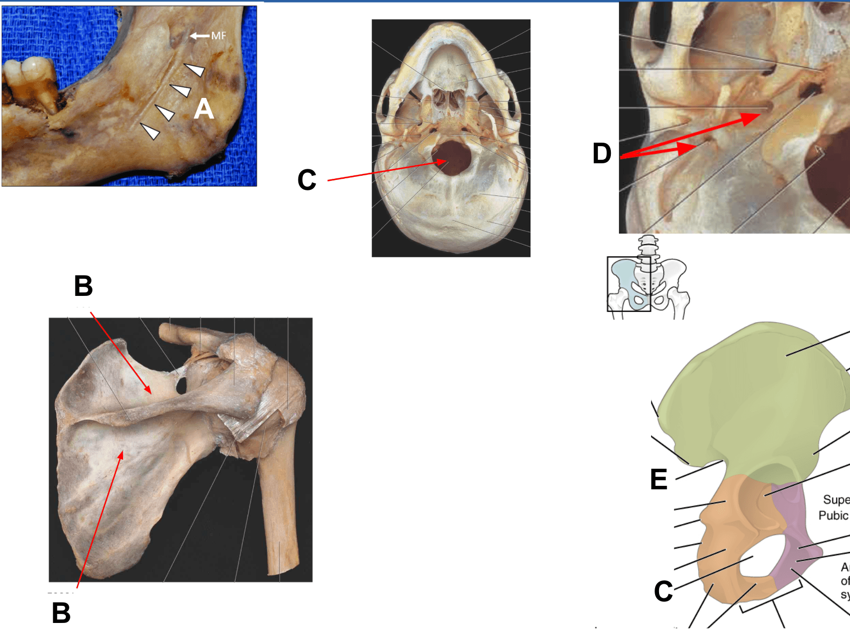 Bone Markings Biology Quiz Quizizz   0e011537 8968 4660 83ff 7f6d2a988c69