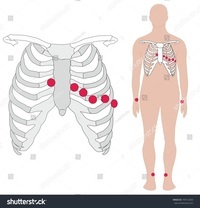 ECG - Year 12 - Quizizz