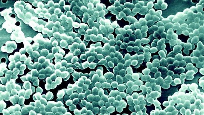 bakteri dan archaea - Kelas 3 - Kuis