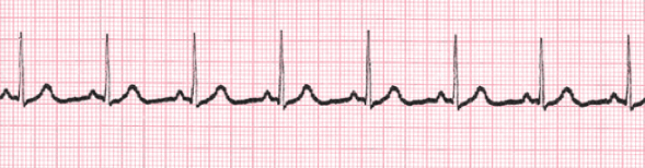 EKG Practice Quiz: Heart Rate and Cardiac Output | 76 plays | Quizizz