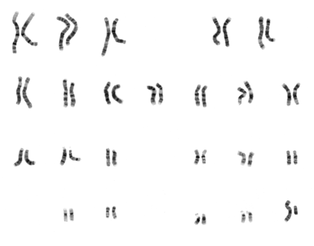 genetic-disorder-and-karyotype-review-quiz-quizizz