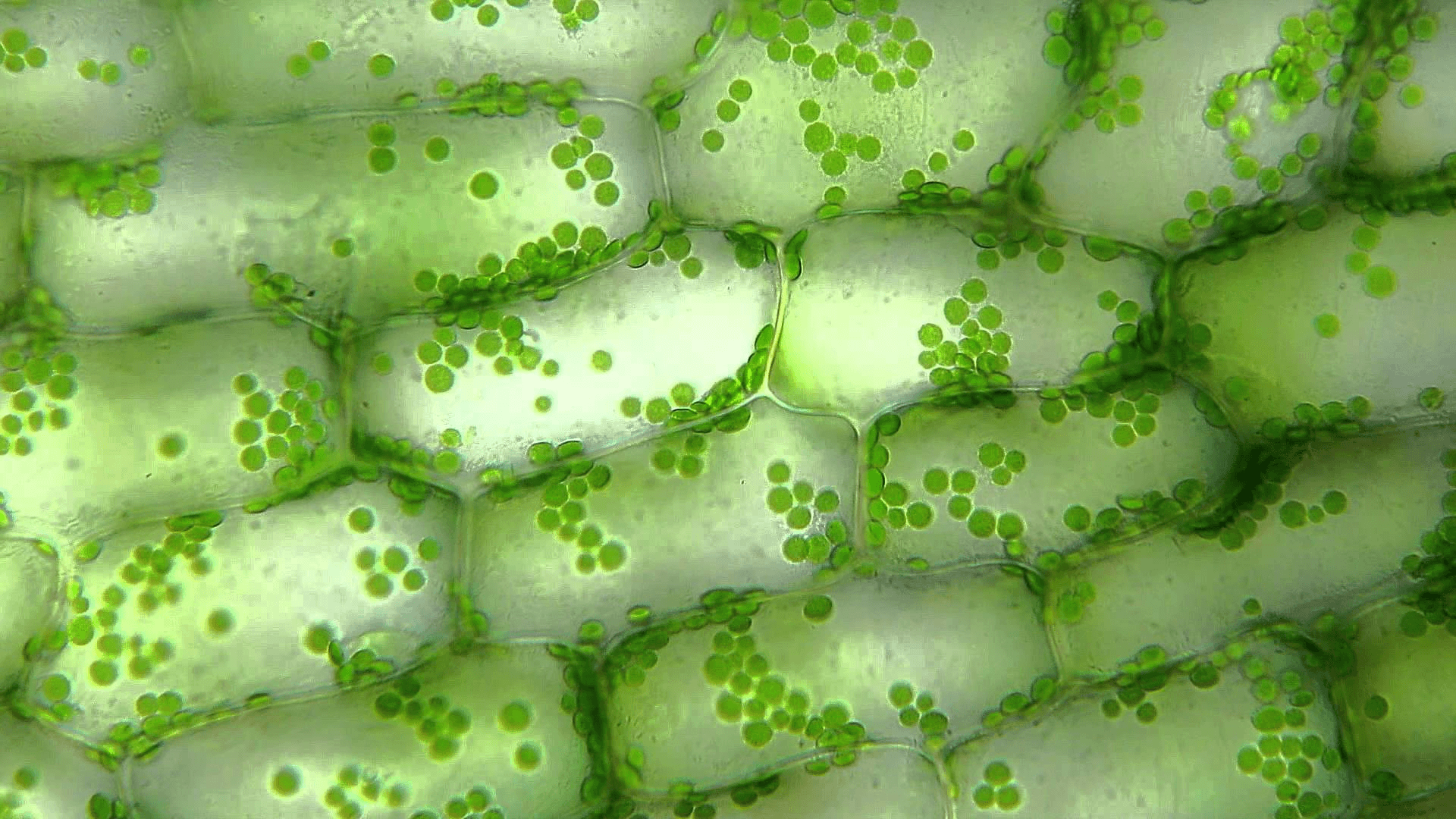 elodea cells under a microscope