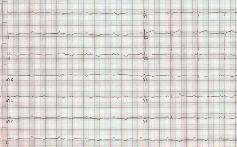 EKG - ระดับชั้น 3 - Quizizz