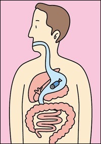 proses endotermik dan eksotermik - Kelas 7 - Kuis