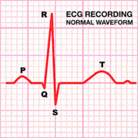 eletrocardiograma - Série 1 - Questionário