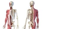 Melengkungnya tulang punggung ke arah depan akibat kesalahan sikap disebut