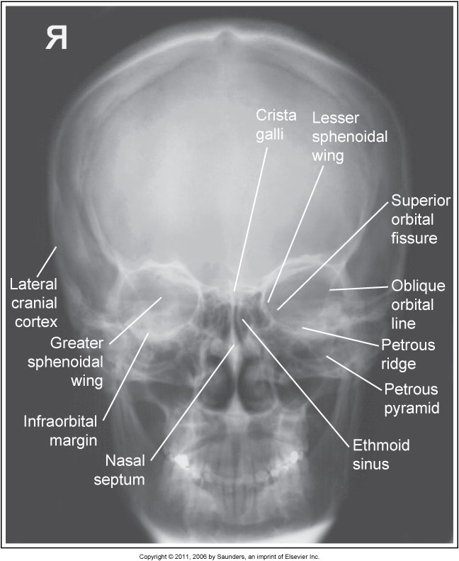 Skull Radiography | 163 plays | Quizizz