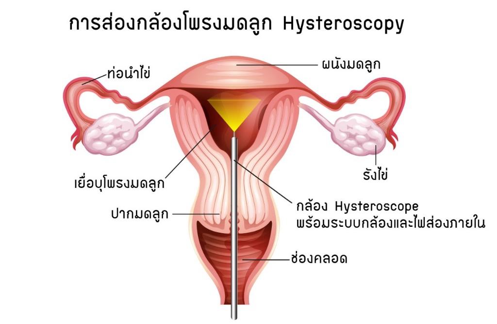 ระบบสืบพันธุ์ Flashcards - แบบทดสอบ