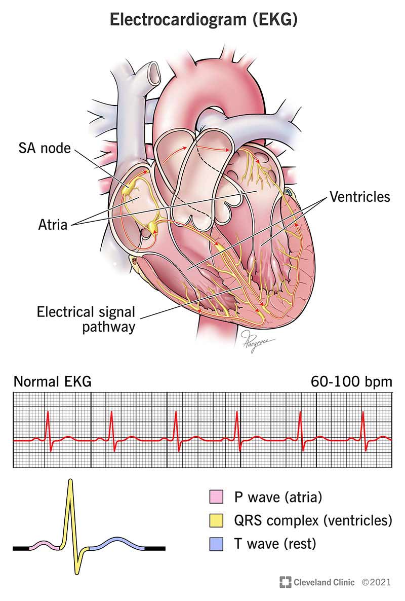 ECG - Grade 11 - Quizizz