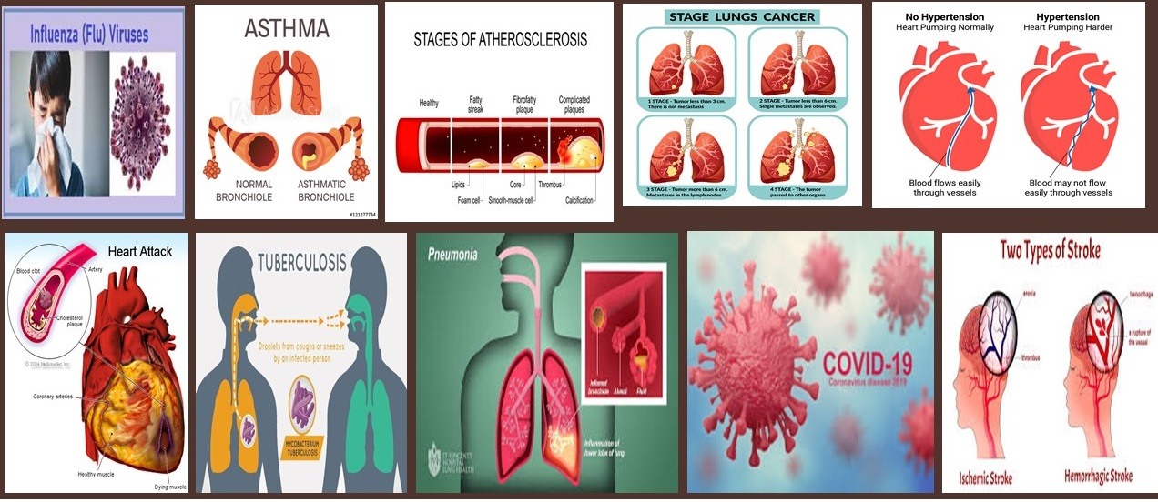 Q2 Diseases Of The Respiratory And Circulatory System | 284 Plays | Quizizz