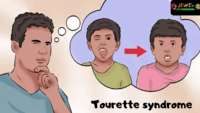 Tourette Syndrome Quiz