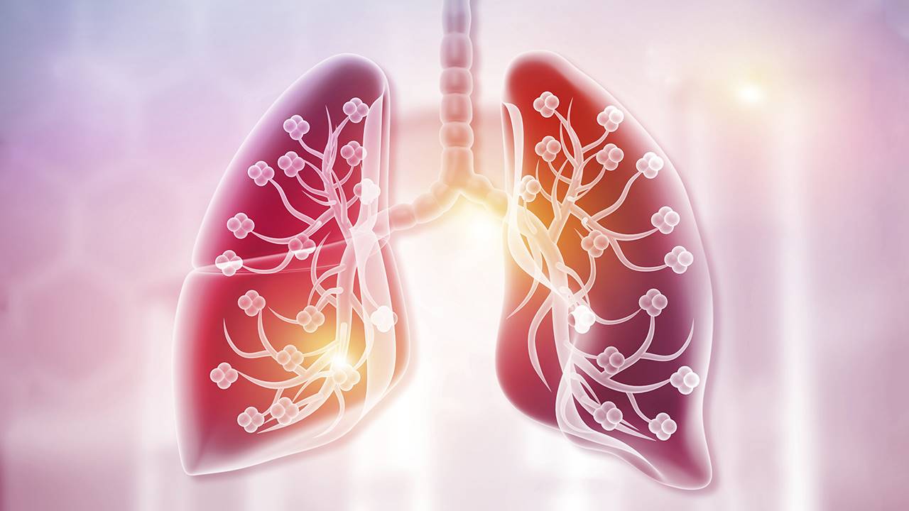 Bronquitis I Pneumonia 