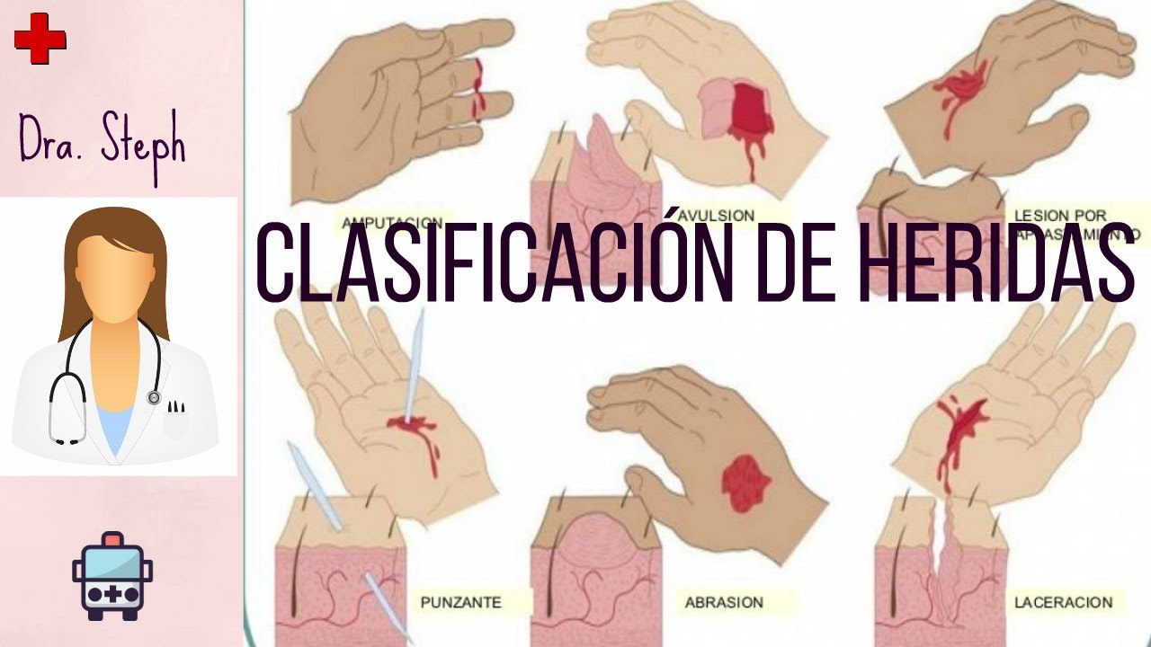 Tipos de Heridas 