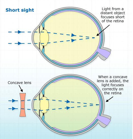 Eye recap | Biology - Quizizz