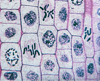 IB Biology 1.6 & 1.1 Slides: Mitosis & Stem Cells