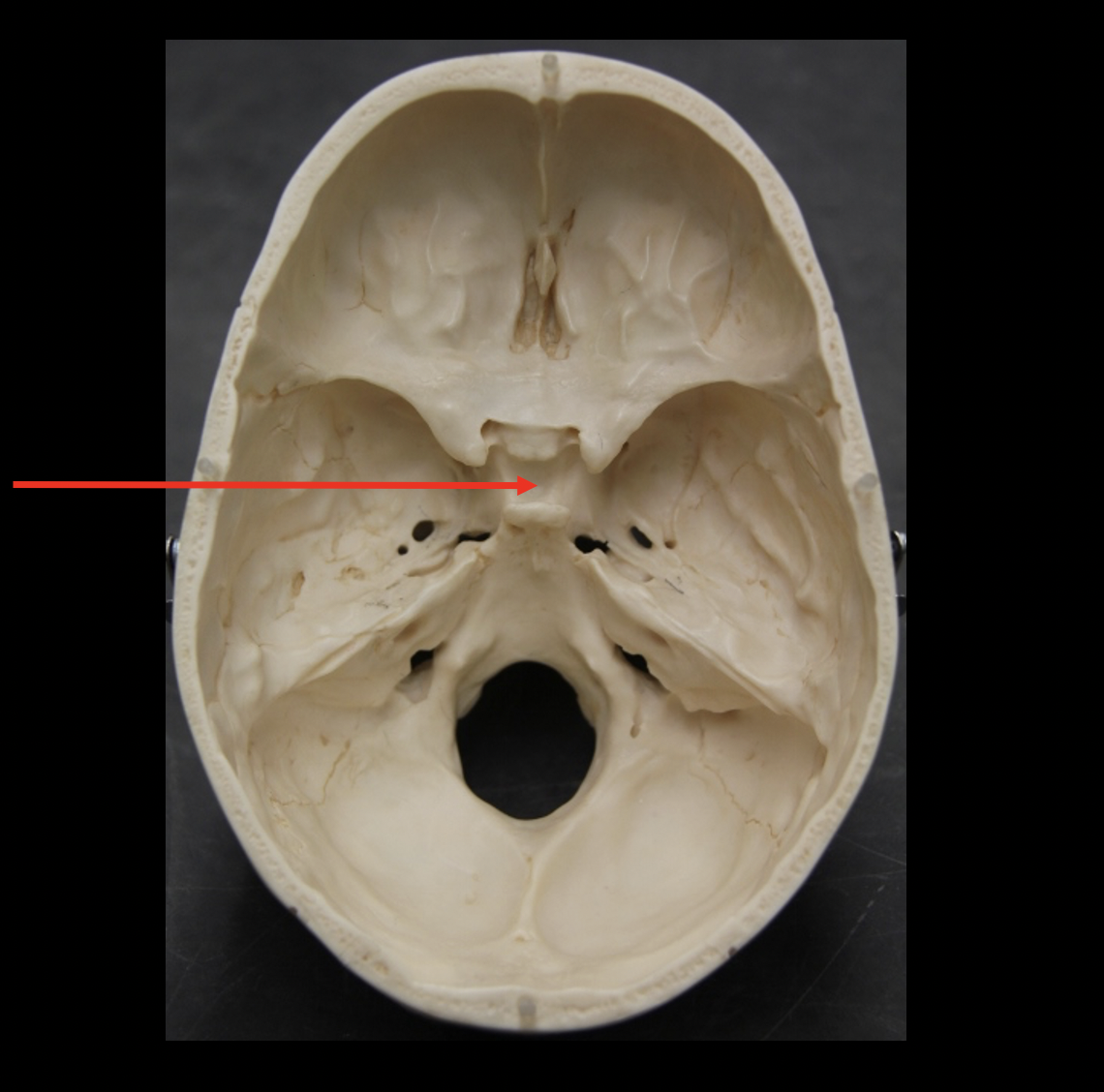 Sphenoid Bone | Science - Quizizz