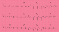 ECG - Class 1 - Quizizz