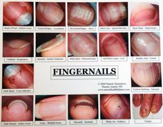 Tle9 Quiz 2 Nail Disorders And Diseases Other Quizizz