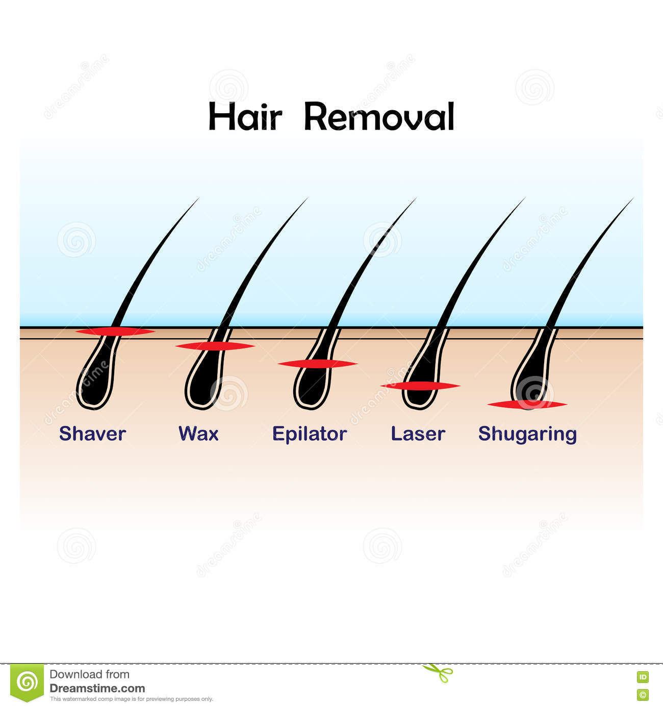 Hair Removal Quizizz