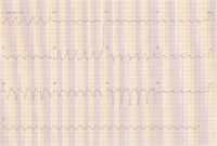 ECG - Grado 1 - Quizizz