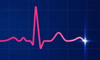 EKG Flashcards - Quizizz