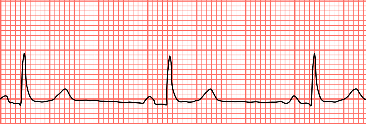 eletrocardiograma - Série 1 - Questionário