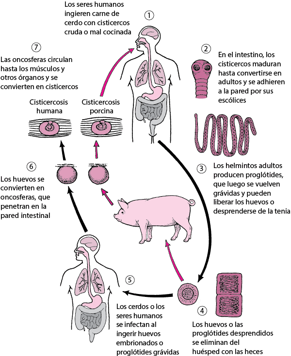 Cisticercosis | Quizizz