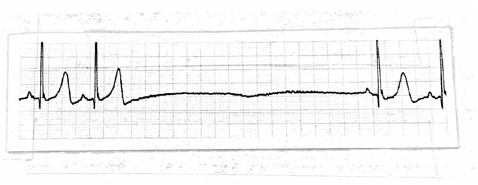 EKG - ระดับชั้น 11 - Quizizz
