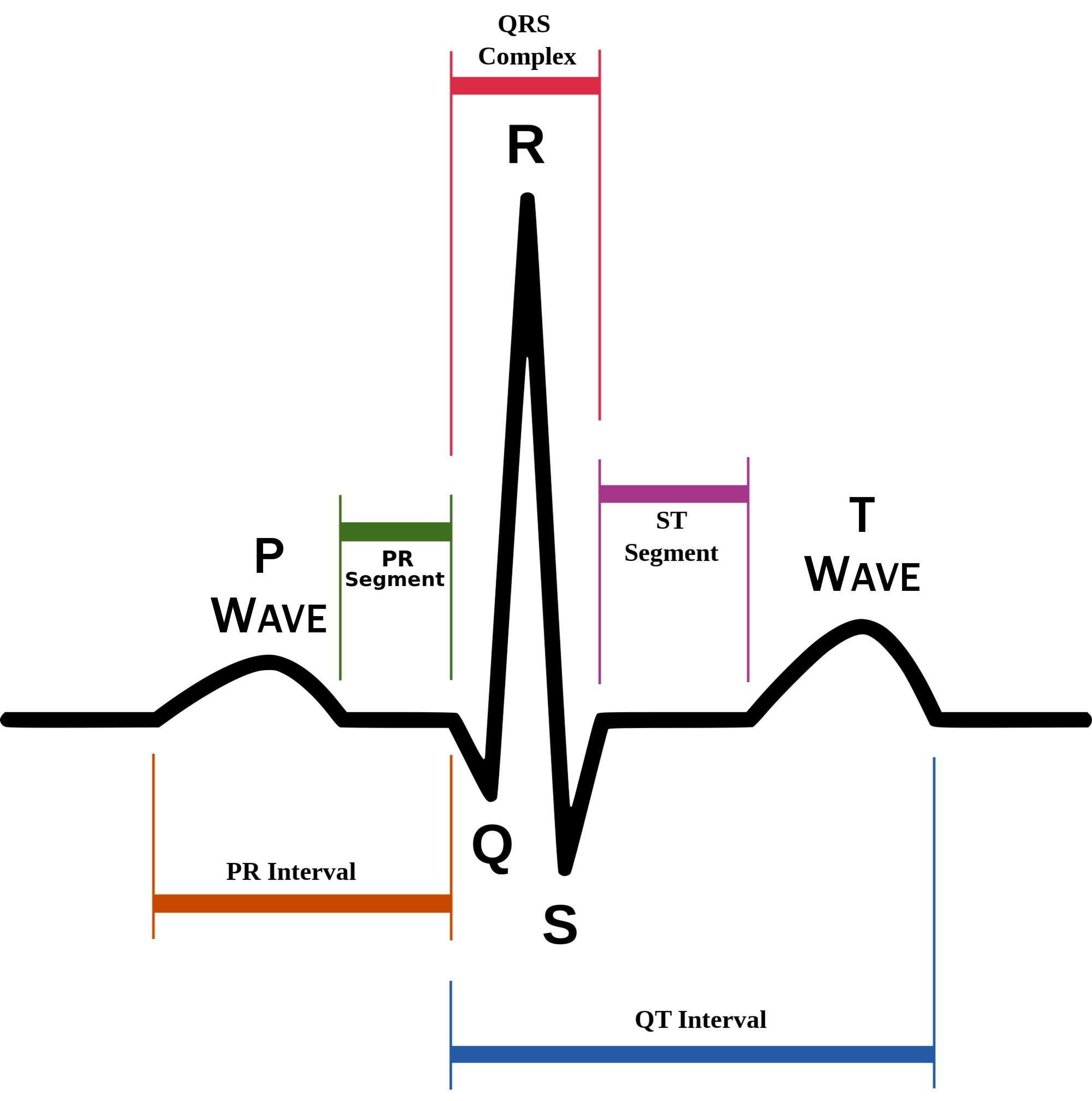 EKG - ระดับชั้น 12 - Quizizz