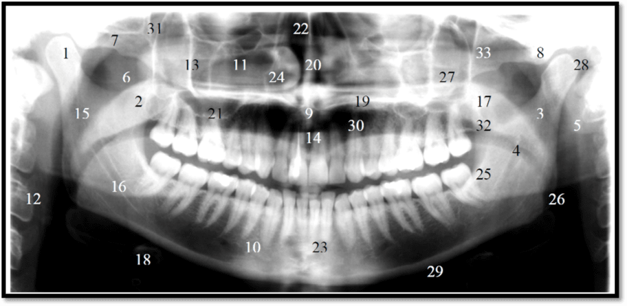 Orthopantogram