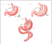 the digestive and excretory systems - Year 12 - Quizizz