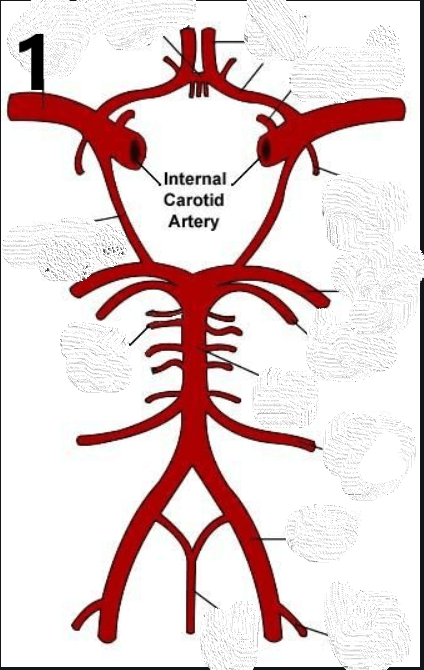 Circle of Willis Anatomy Review for Strokes | 142 plays | Quizizz