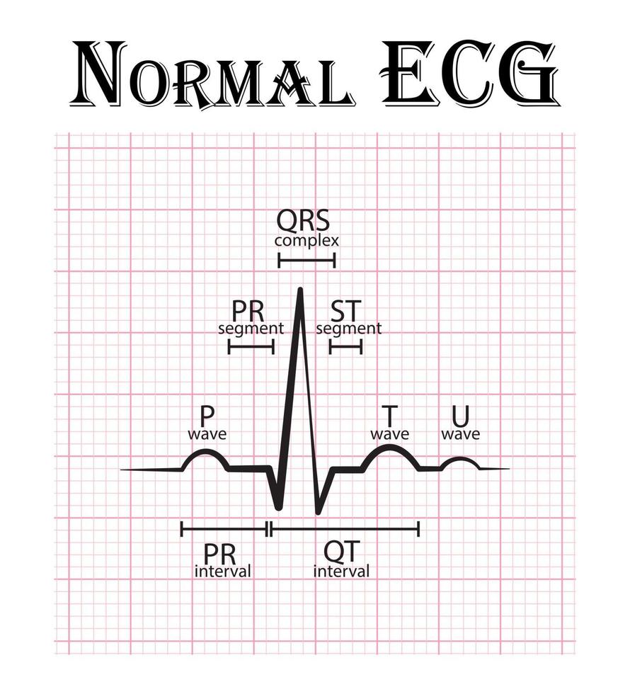 ekg-biology-quizizz