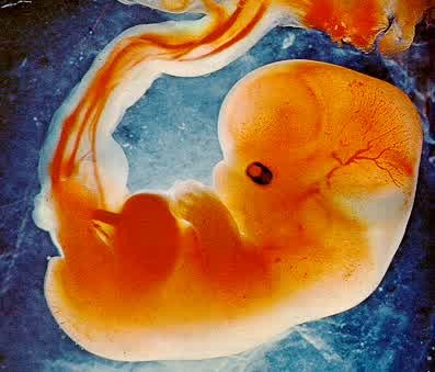 Zigot merupakan hasil peleburan ovum dan sperma yang akan tumbuh kemudian menempel di dinding uterus dalam bentuk