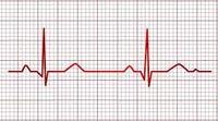 eletrocardiograma - Série 5 - Questionário