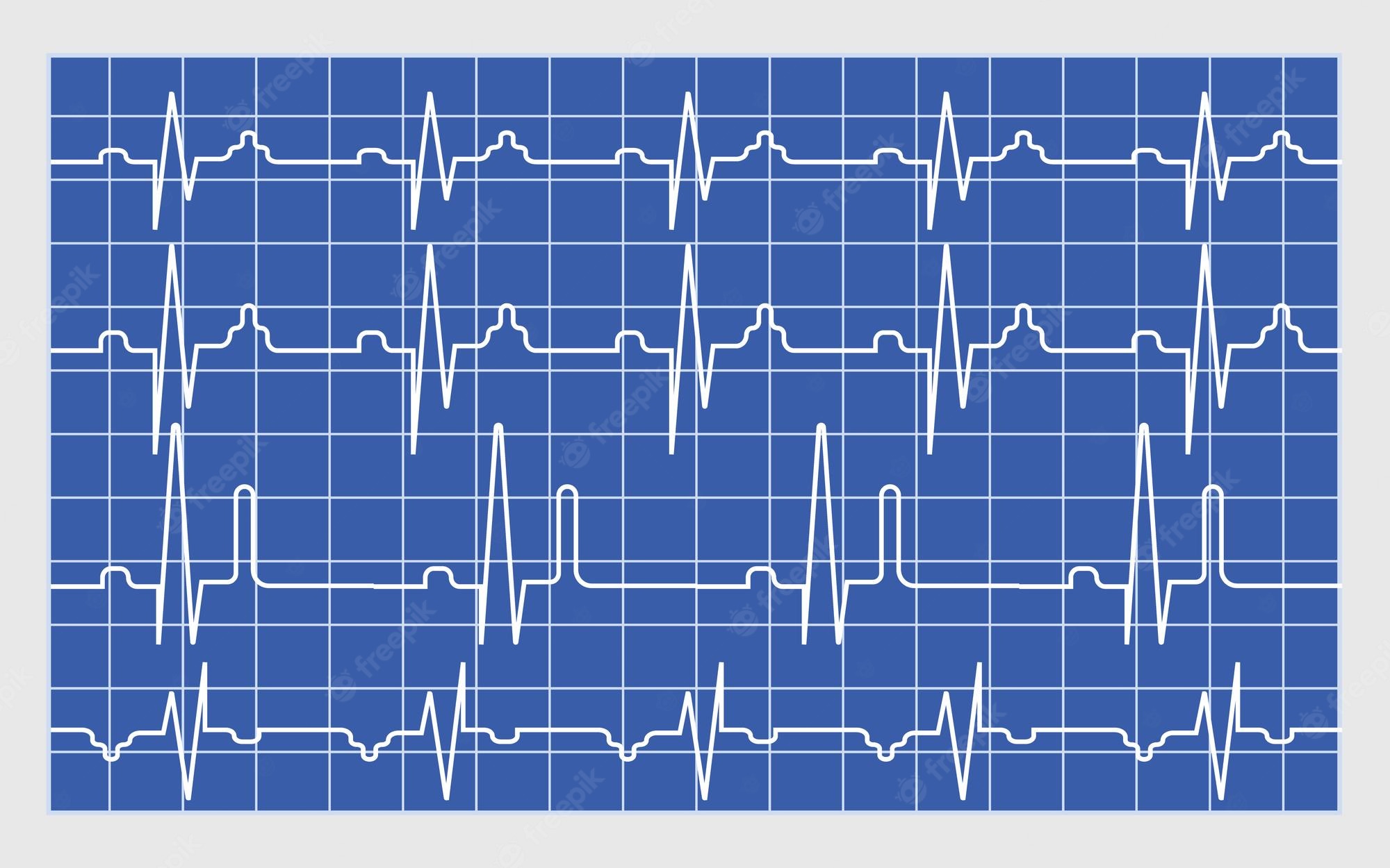 EKG - Year 1 - Quizizz